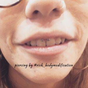 smiley piercing by @rick_bodymodification