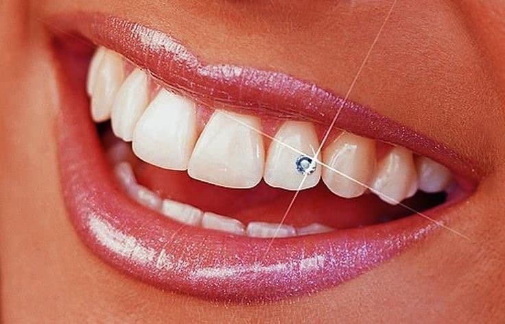 piercing dente brillantino