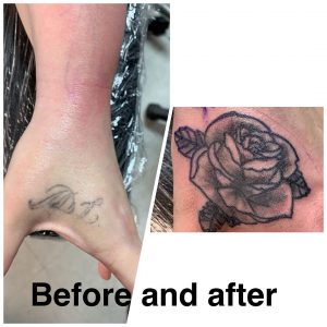 cover-up-e-laser-tattoo-by-@needles_ink___